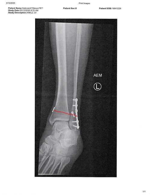 SteveLeg.jpg